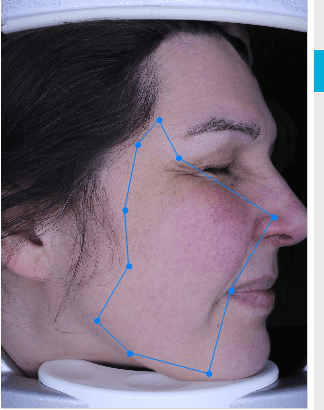 aparatizaanalizukoze