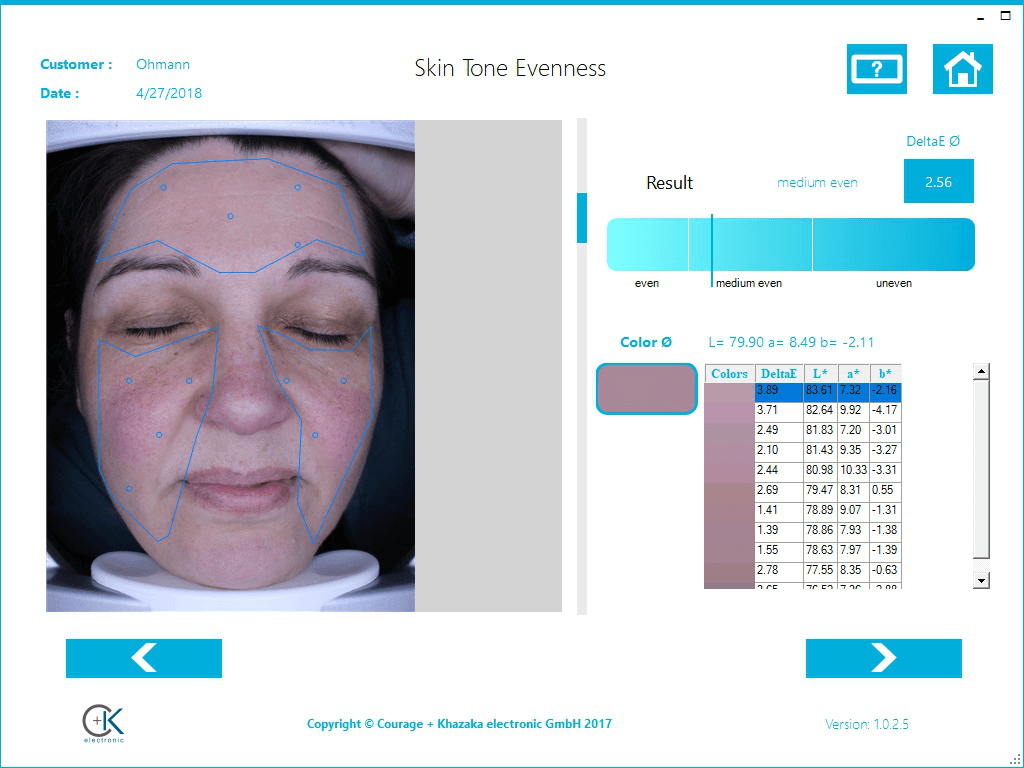 aparatizaanalizukoze