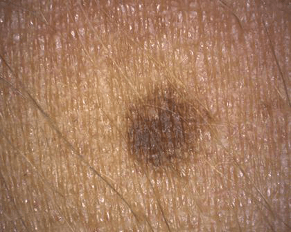 aparatizaanalizukoze