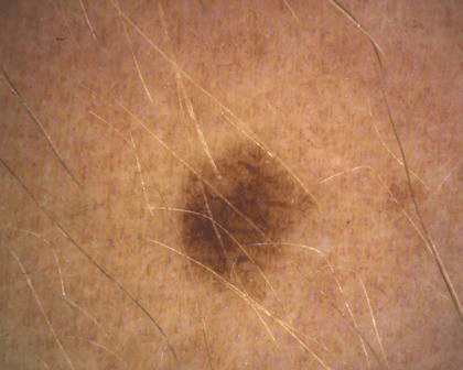 aparatizaanalizukoze