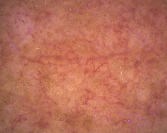 aparatizaanalizukoze