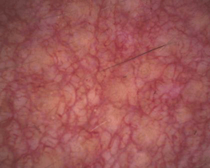 aparatizaanalizukoze