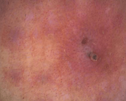 aparatizaanalizukoze