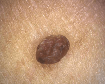 aparatizaanalizukoze