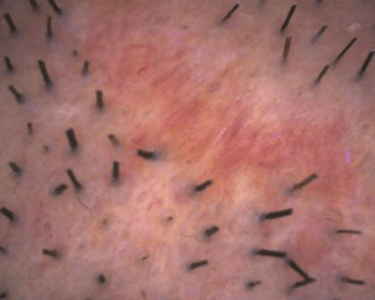 aparatizaanalizukoze