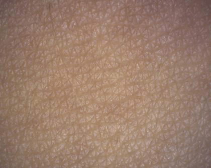 aparatizaanalizukoze