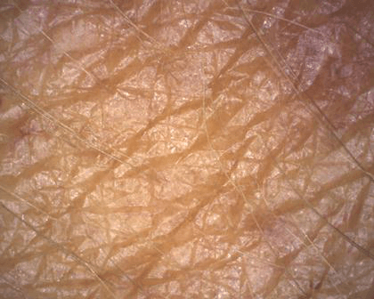 aparatizaanalizukoze