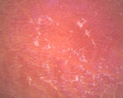 aparatizaanalizukoze