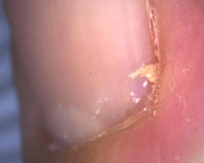 aparatizaanalizukoze