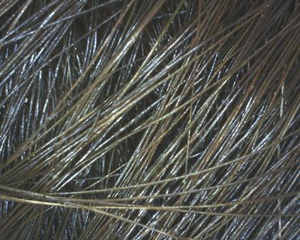 aparatizaanalizukoze