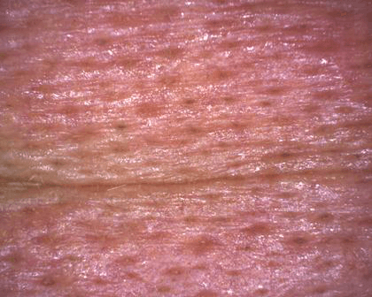 aparatizaanalizukoze